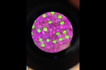 Stomata observed in the leaf cells of Tradescantia zerbina