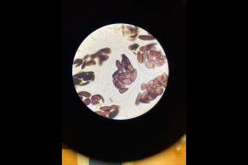 Microscope image of an unripe banana